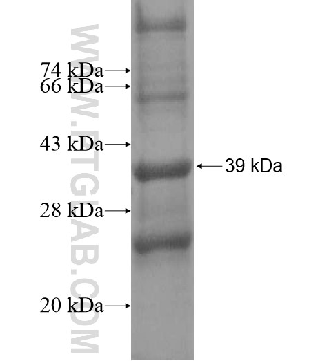 C11orf76 fusion protein Ag13880 SDS-PAGE C11orf76 fusion protein Ag13880 SDS-PAGE