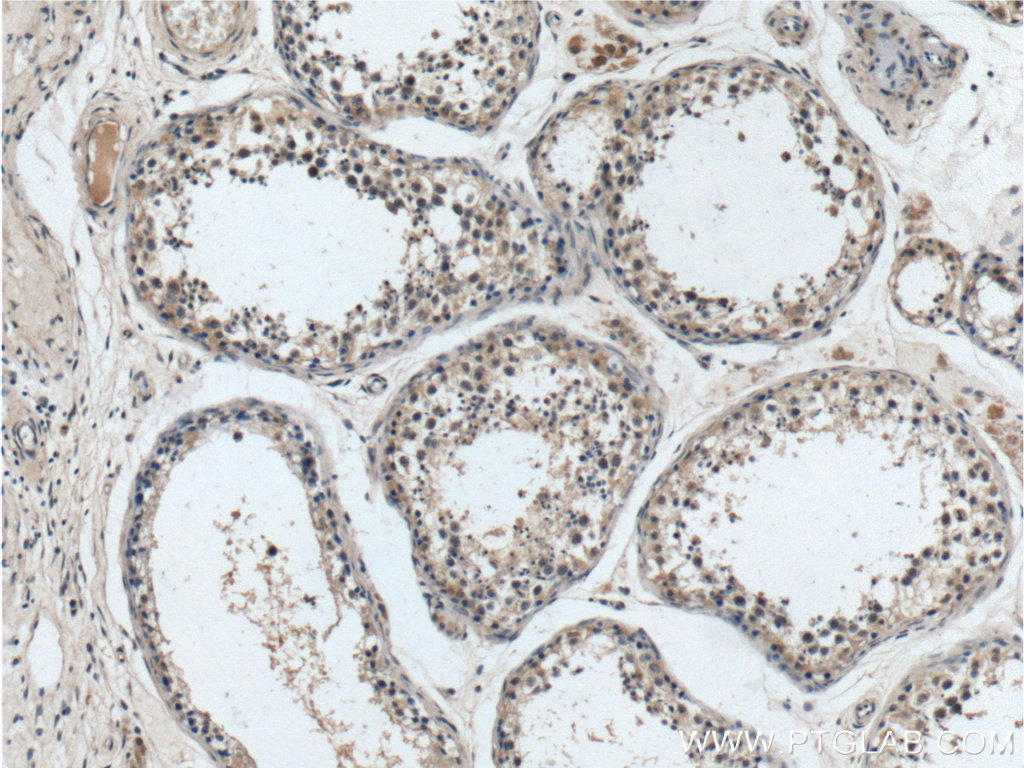 IHC staining of human testis using 19906-1-AP