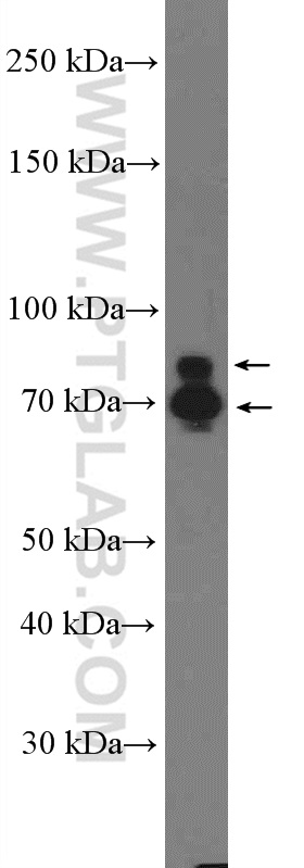 WB analysis of L02 using 25957-1-AP