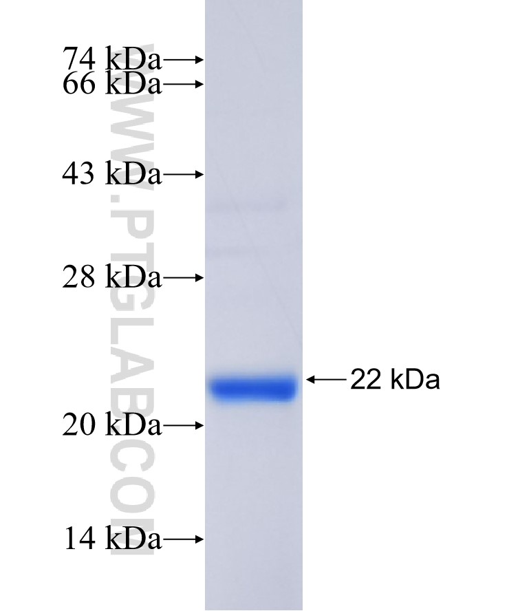 C11orf84 fusion protein Ag36080 SDS-PAGE C11orf84 fusion protein Ag36080 SDS-PAGE