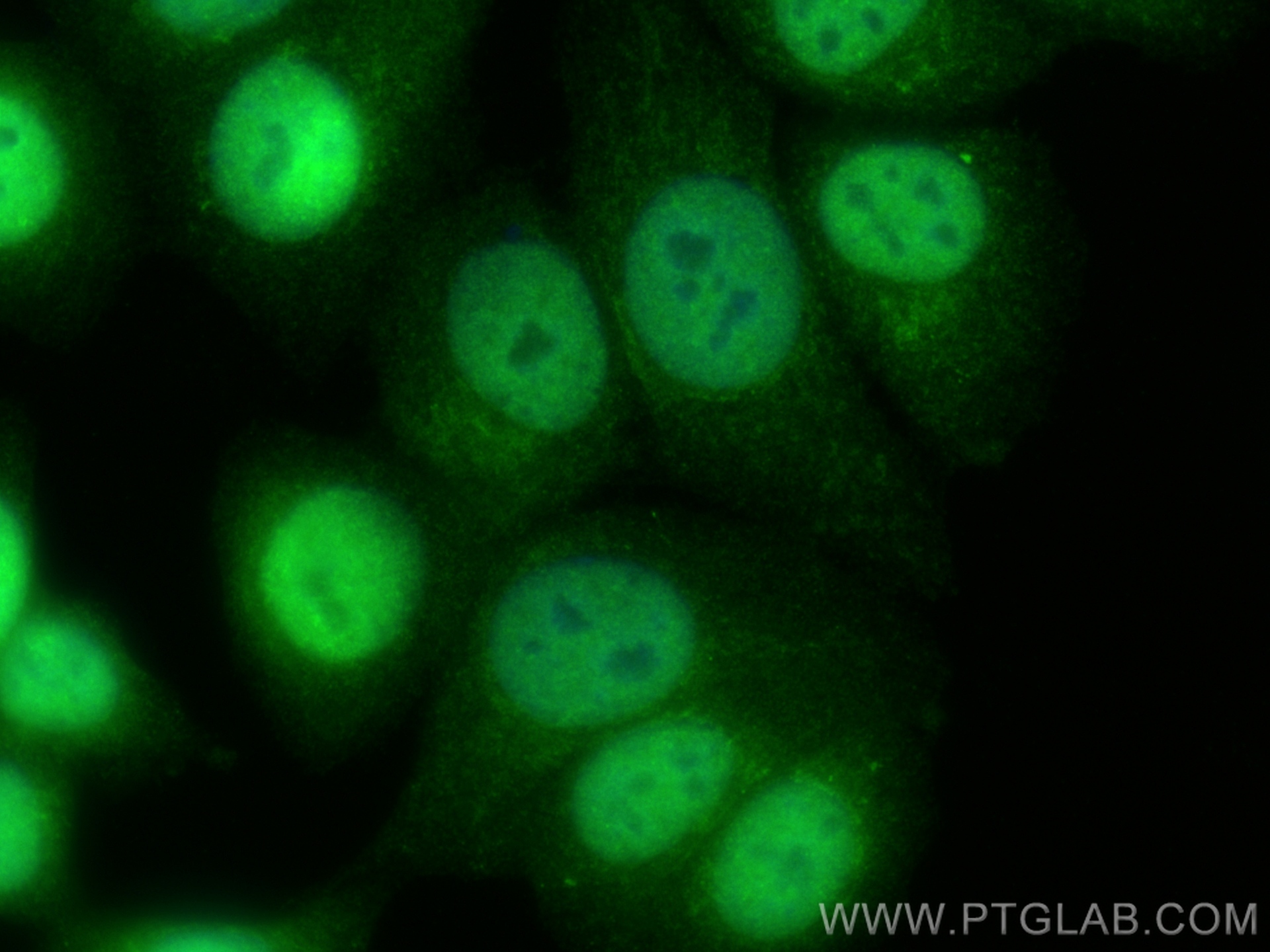 IF Staining of MCF-7 using 19892-1-AP