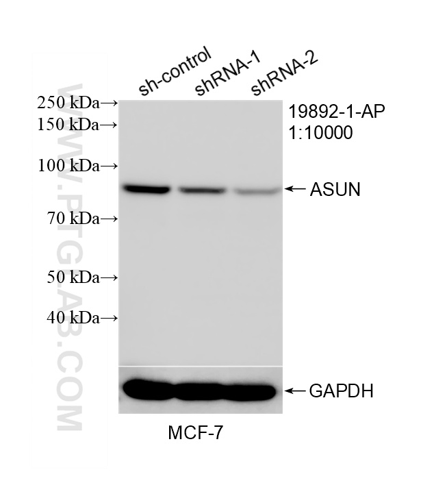 WB result of ASUN antibody (19892-1-AP; 1:10000; incubated at room temperature for 1.5 hours) with sh-Control and sh-ASUN transfected MCF-7 cells. WB analysis of MCF-7 using 19892-1-AP