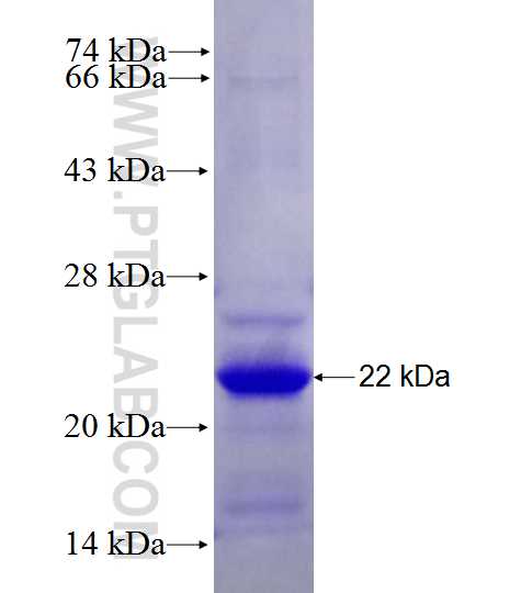 C12orf24 fusion protein Ag27910 SDS-PAGE C12orf24 fusion protein Ag27910 SDS-PAGE