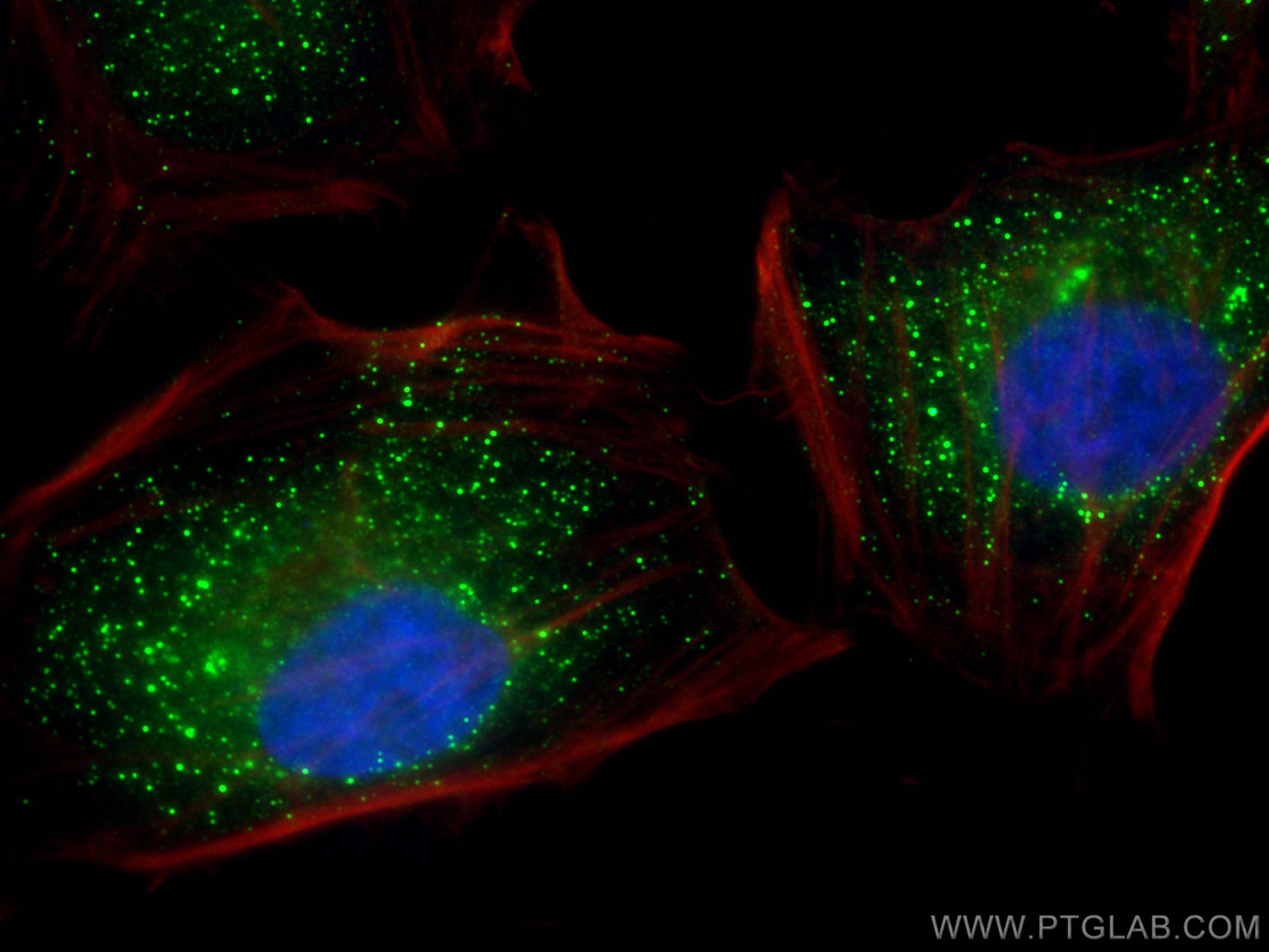 IF Staining of HeLa using 31647-1-AP
