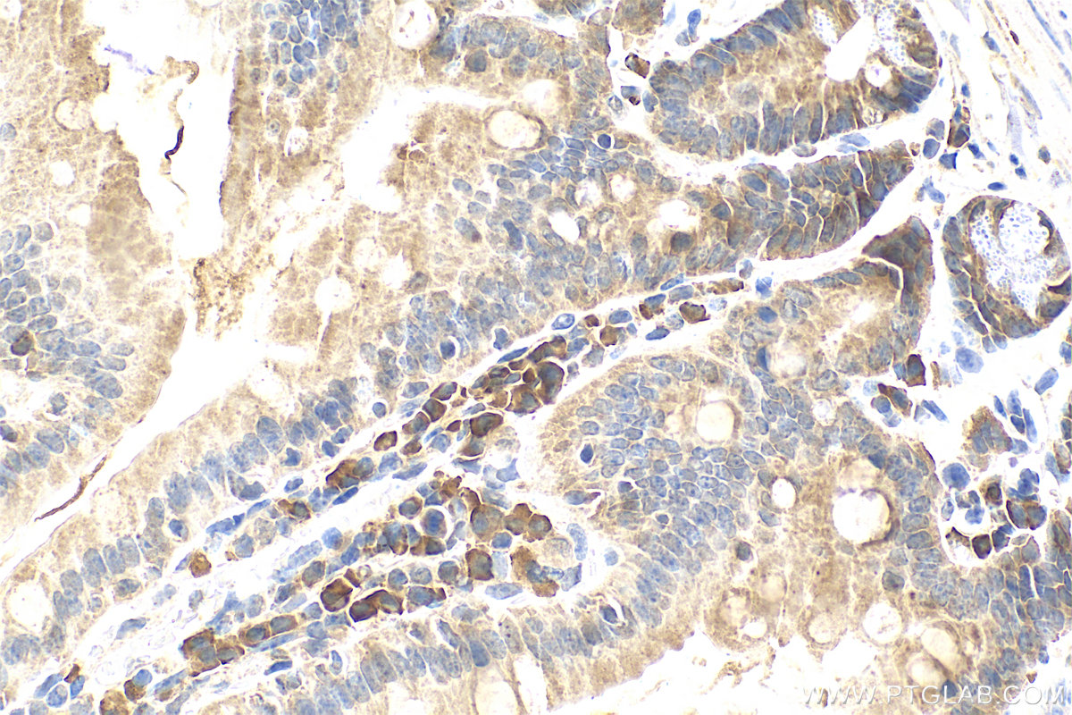 IHC staining of mouse small intestine using 31647-1-AP