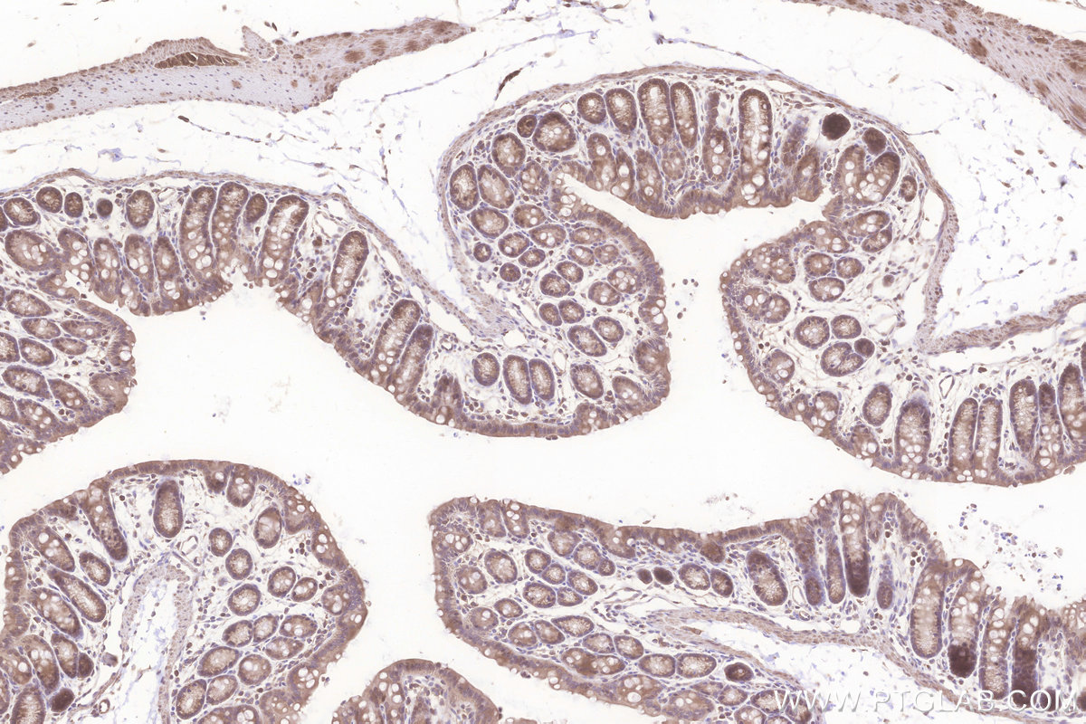 IHC staining of mouse colon using 31647-1-AP IHC staining of mouse colon using 31647-1-AP