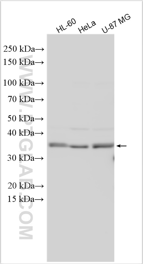 WB analysis using 31647-1-AP