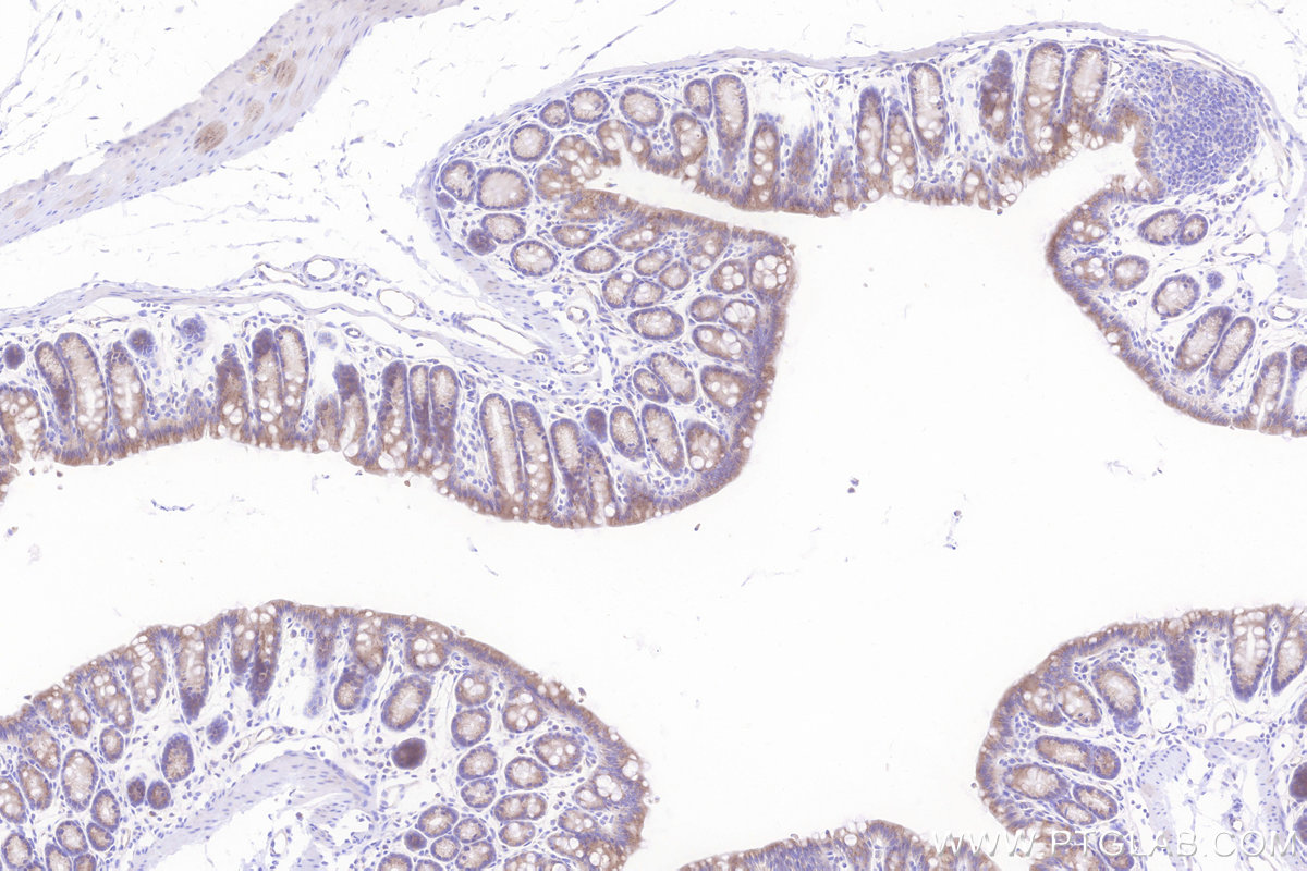 IHC staining of mouse colon using 84708-1-RR