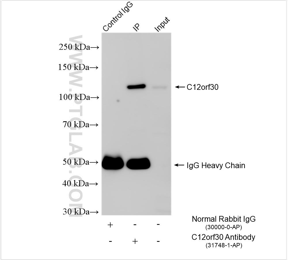 IP experiment of mouse ovary using 31748-1-AP