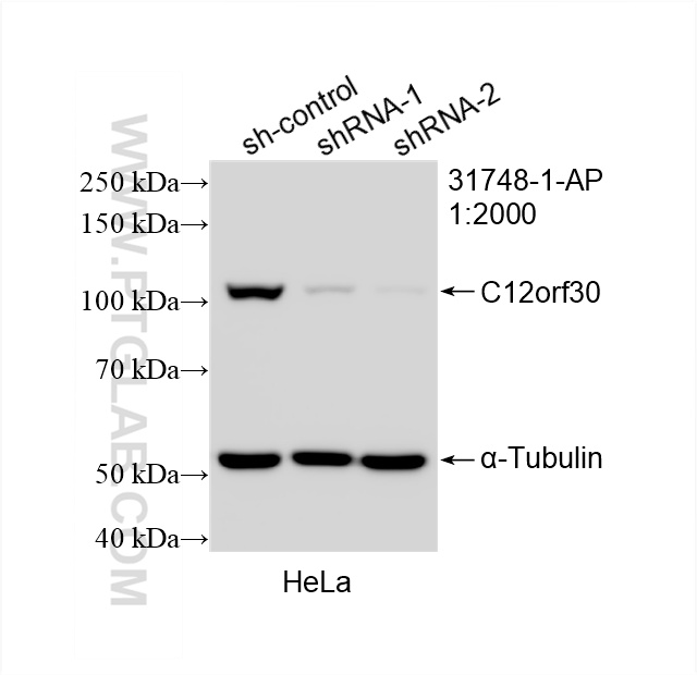 WB analysis of HeLa using 31748-1-AP