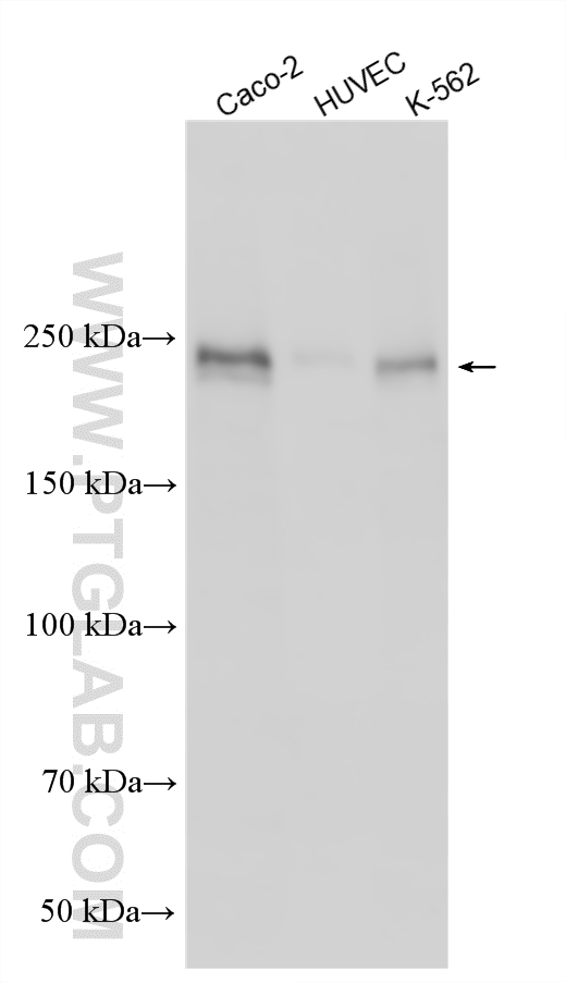 WB analysis using 33680-1-AP (same clone as 33680-1-PBS) WB analysis using 33680-1-AP (same clone as 33680-1-PBS)