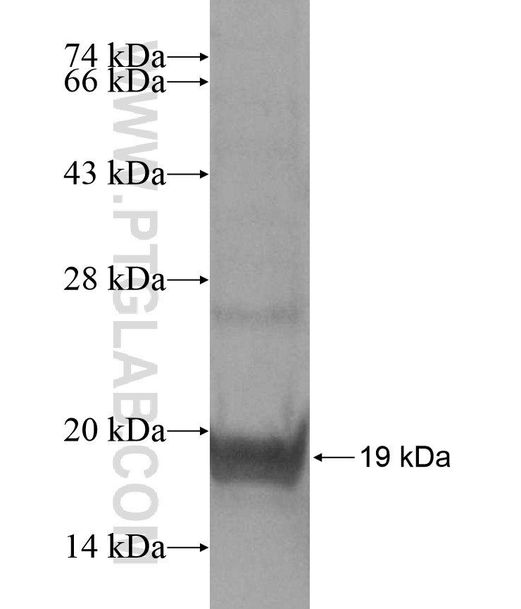 C12orf39 fusion protein Ag16957 SDS-PAGE C12orf39 fusion protein Ag16957 SDS-PAGE