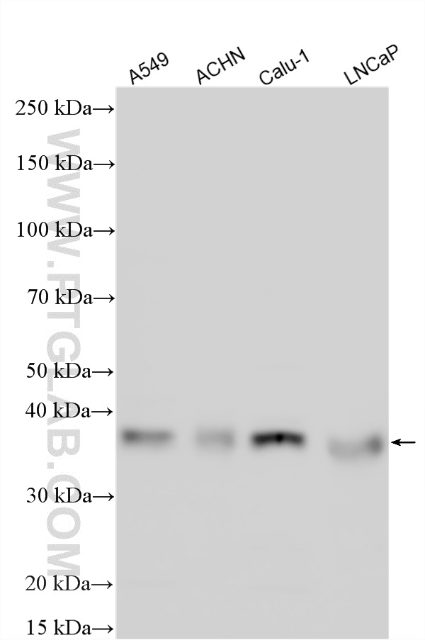 WB analysis using 33971-1-AP (same clone as 33971-1-PBS) WB analysis using 33971-1-AP (same clone as 33971-1-PBS)