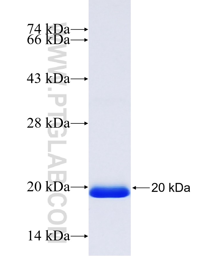 C12orf43 fusion protein Ag40595 SDS-PAGE C12orf43 fusion protein Ag40595 SDS-PAGE