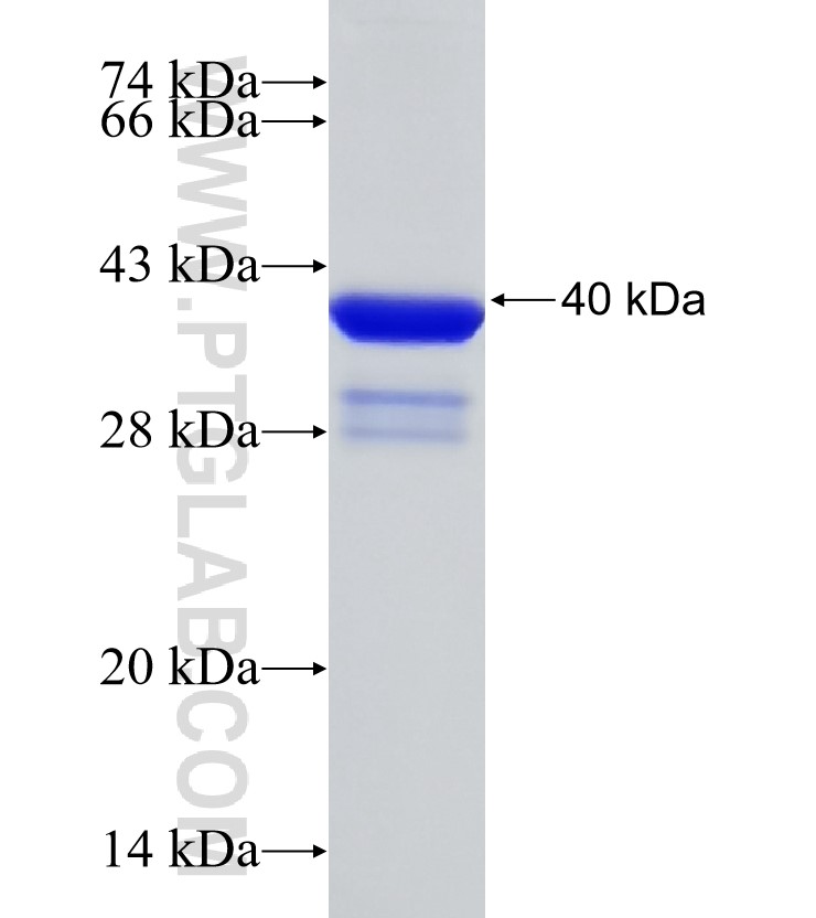 C12orf45 fusion protein Ag31258 SDS-PAGE
