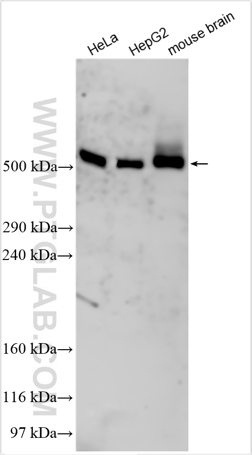 WB analysis using 20609-1-AP
