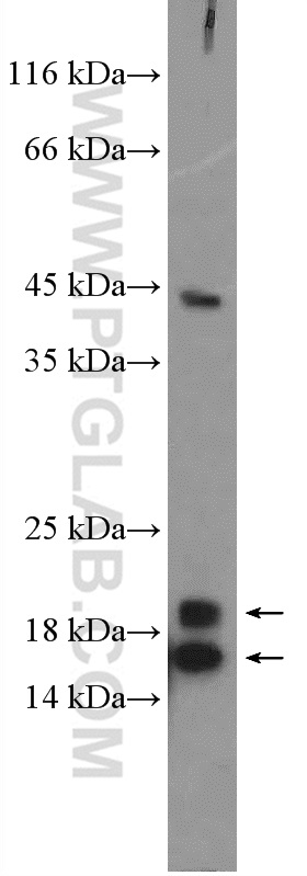 WB analysis of mouse brain using 26510-1-AP