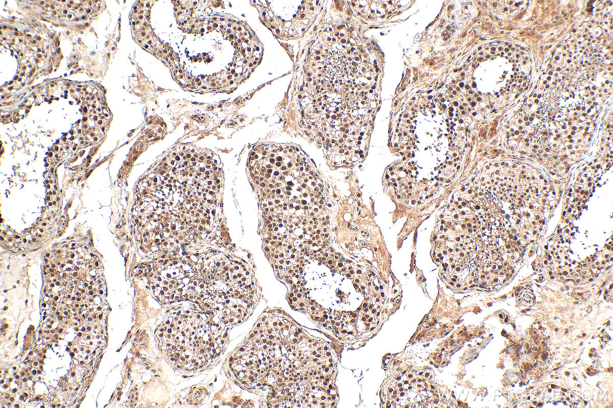 IHC staining of human testis using 21183-1-AP (same clone as 21183-1-PBS)