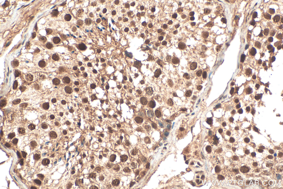 IHC staining of human testis using 21183-1-AP (same clone as 21183-1-PBS)