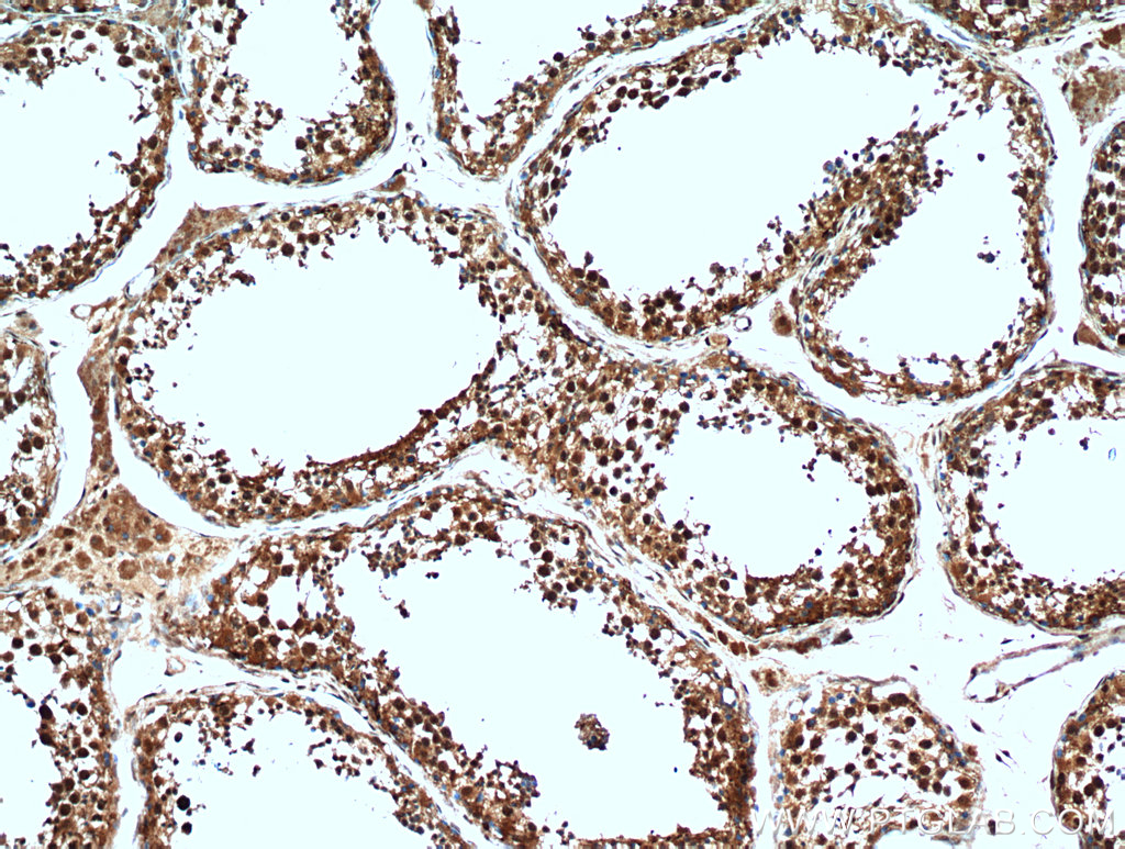 IHC staining of human testis using 21183-1-AP (same clone as 21183-1-PBS)