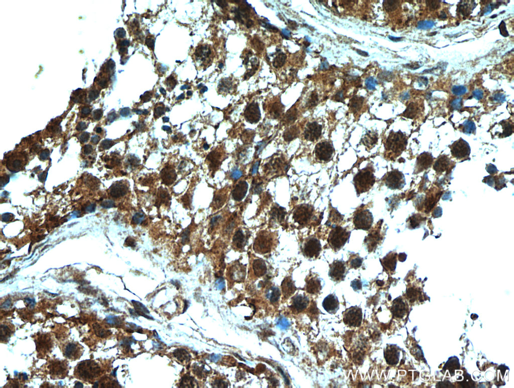 IHC staining of human testis using 21183-1-AP (same clone as 21183-1-PBS)