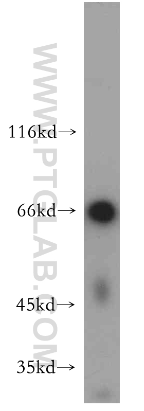 WB analysis of human skeletal muscle using 21183-1-AP (same clone as 21183-1-PBS)