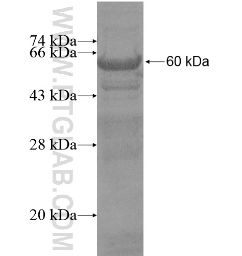 C13orf18 fusion protein Ag15513 SDS-PAGE C13orf18 fusion protein Ag15513 SDS-PAGE