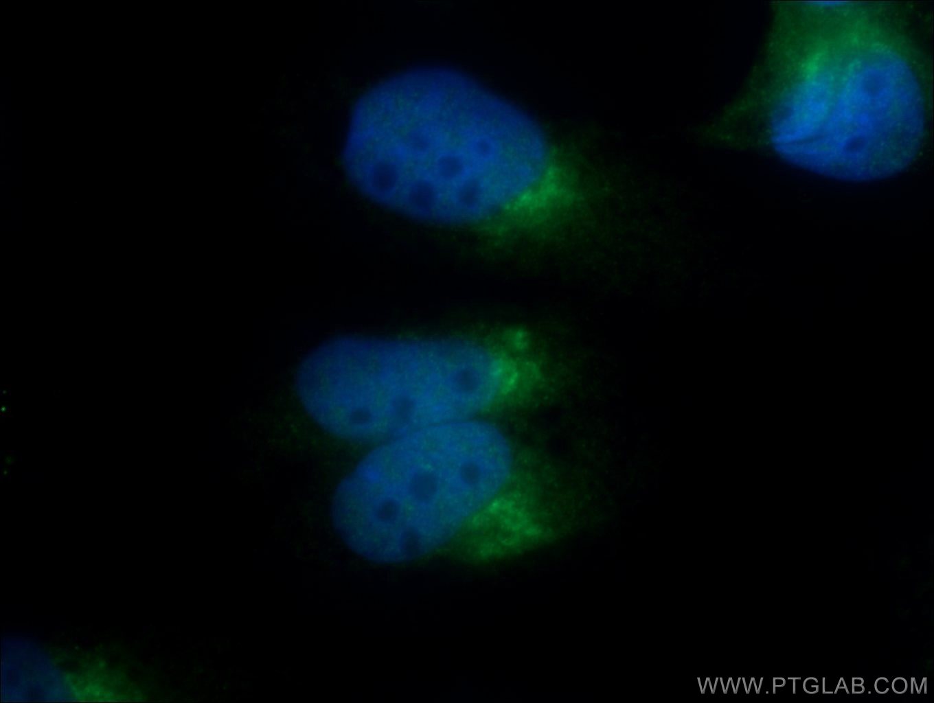 IF Staining of MDCK using 25583-1-AP