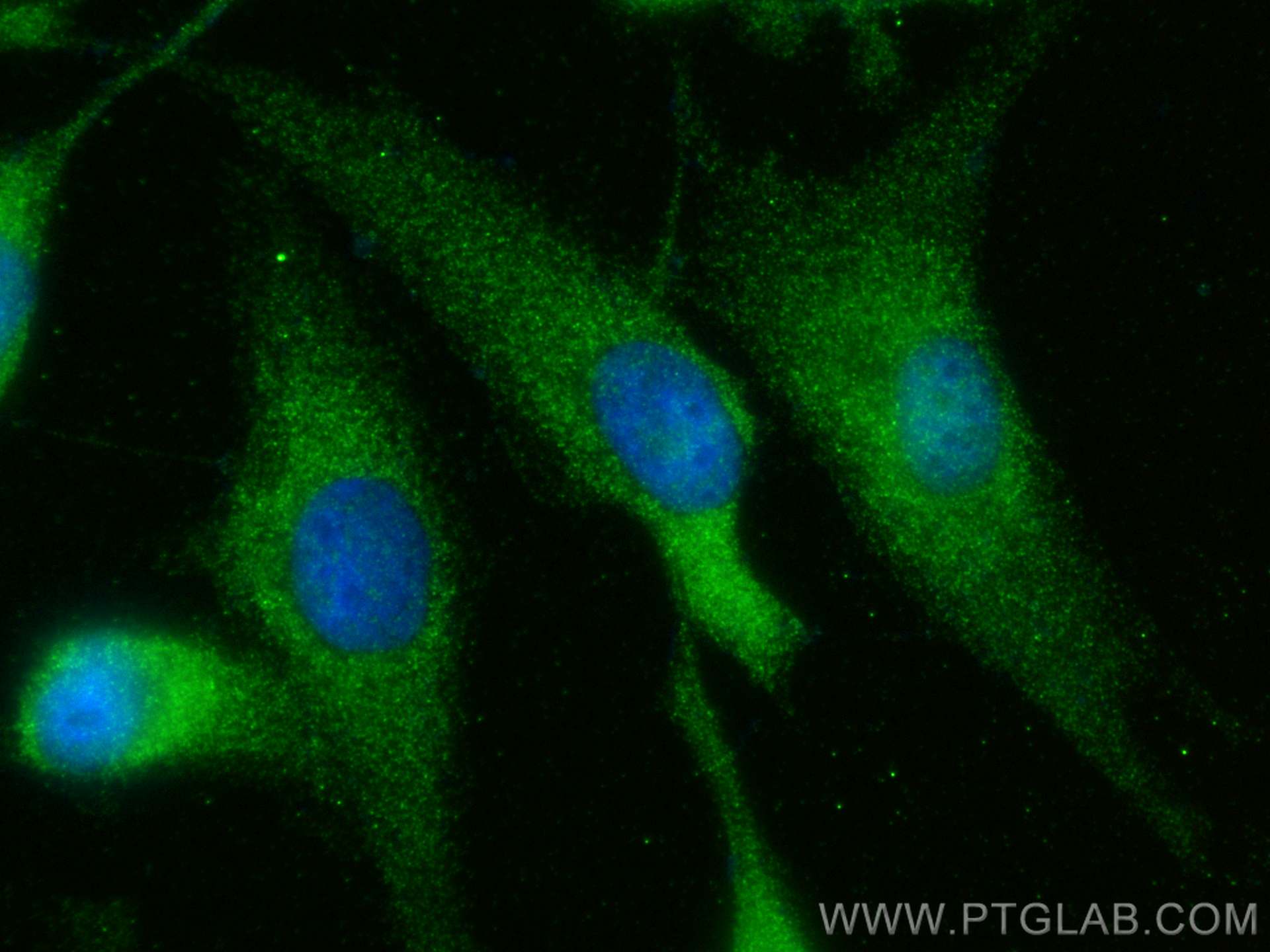 IF Staining of MDCK using 25583-1-AP