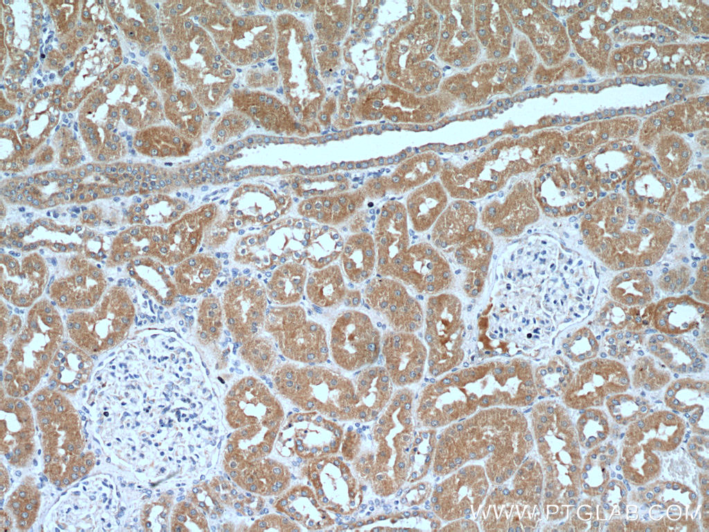 IHC staining of human kidney using 25583-1-AP