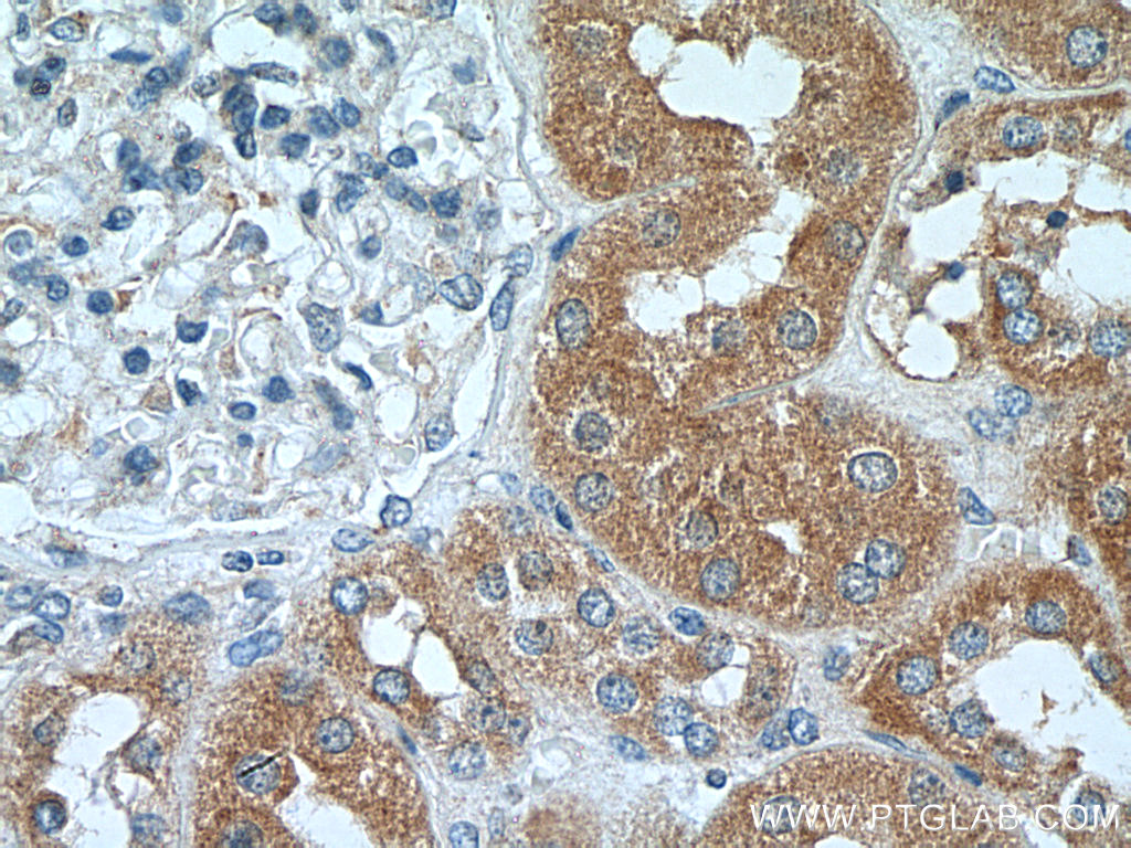 IHC staining of human kidney using 25583-1-AP