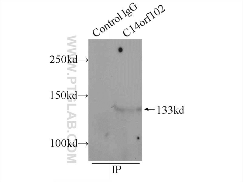 IP experiment of MCF-7 using 24968-1-AP (same clone as 24968-1-PBS)