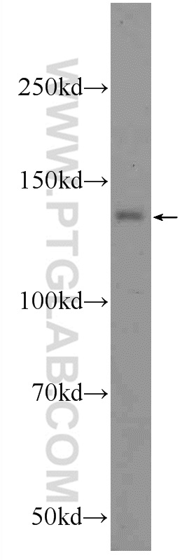 NRDE2