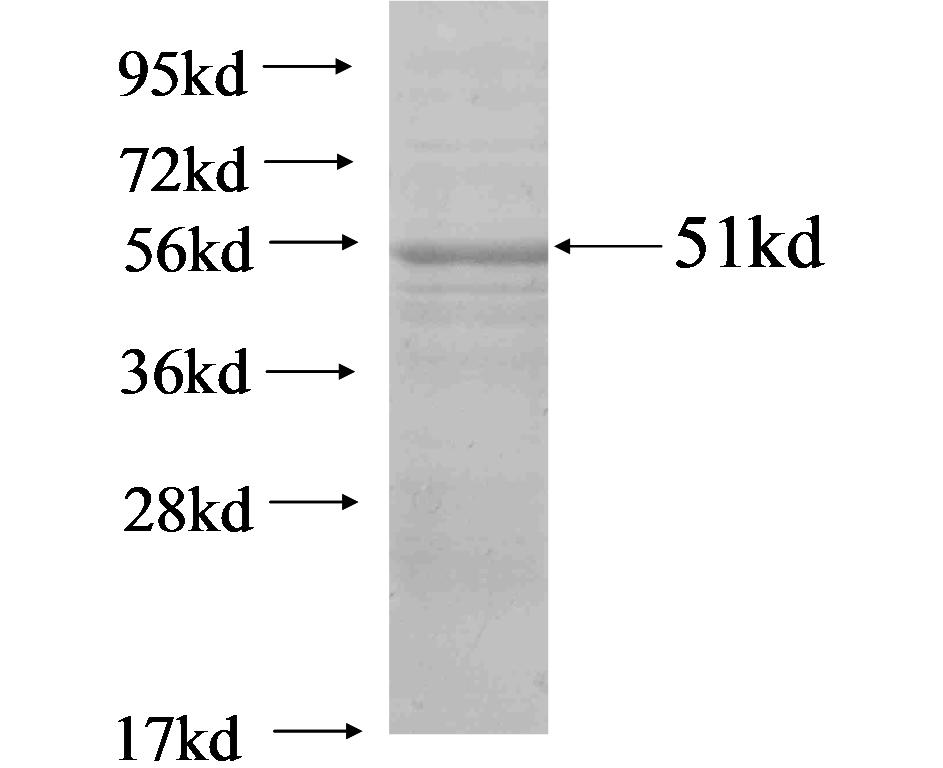 C14orf104 fusion protein Ag19741 SDS-PAGE C14orf104 fusion protein Ag19741 SDS-PAGE