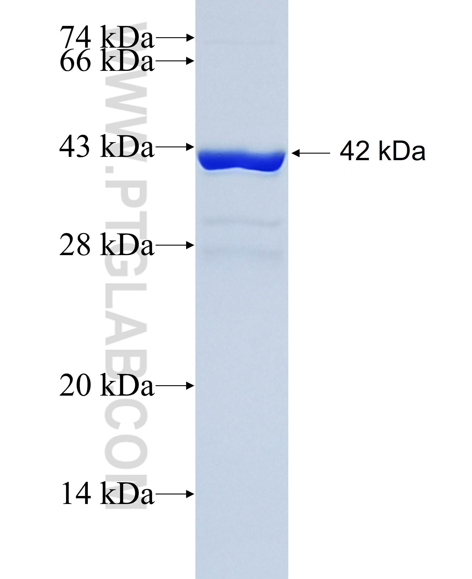 C14orf119 fusion protein Ag23388 SDS-PAGE C14orf119 fusion protein Ag23388 SDS-PAGE