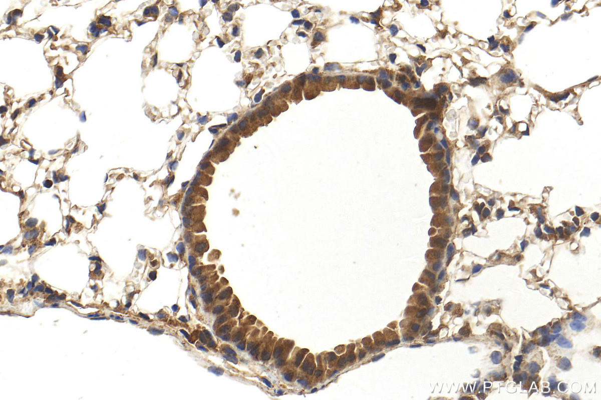 IHC staining of mouse lung using 23923-1-AP