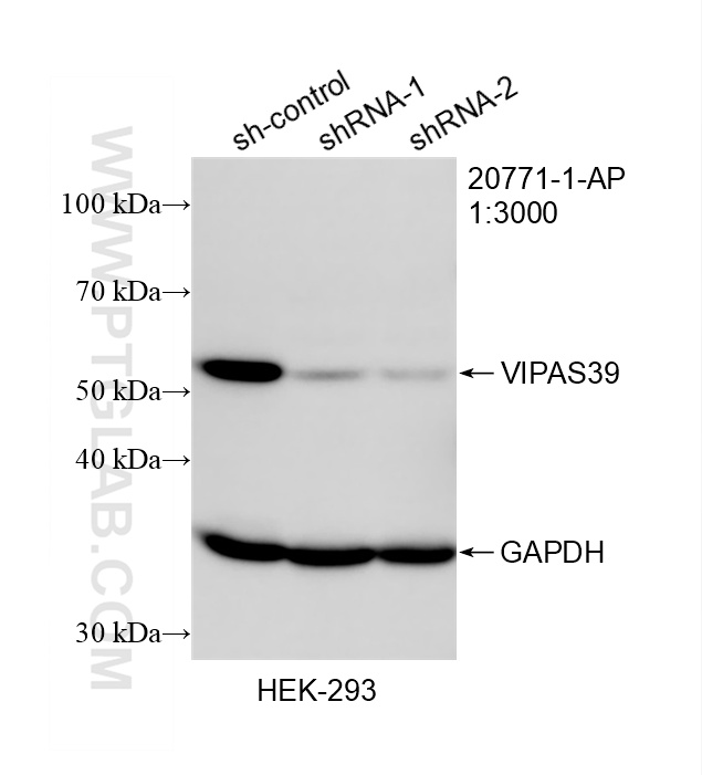 WB result of VIPAS39 antibody (20771-1-AP; 1:3000; incubated at room temperature for 1.5 hours) with sh-Control and sh-VIPAS39 transfected HEK-293 cells. WB analysis of HEK-293 using 20771-1-AP