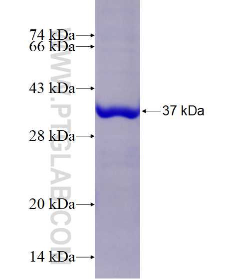 VIPAS39 fusion protein Ag14954 SDS-PAGE