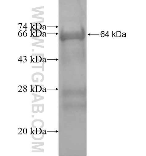 C14orf135 fusion protein Ag15480 SDS-PAGE C14orf135 fusion protein Ag15480 SDS-PAGE
