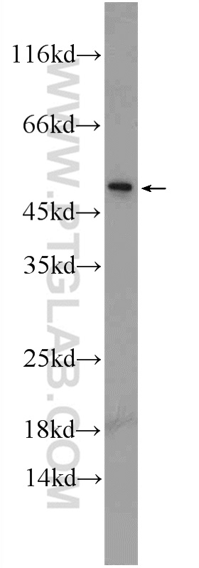 WB analysis of PC-3 using 24722-1-AP