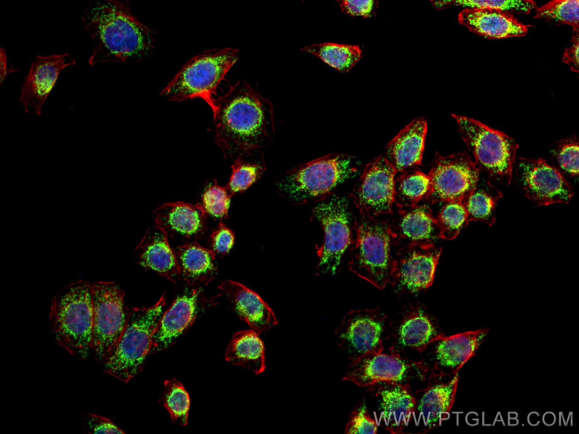 IF Staining of PC-3 using 26006-1-AP