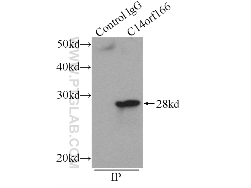 IP experiment of Jurkat using 19848-1-AP