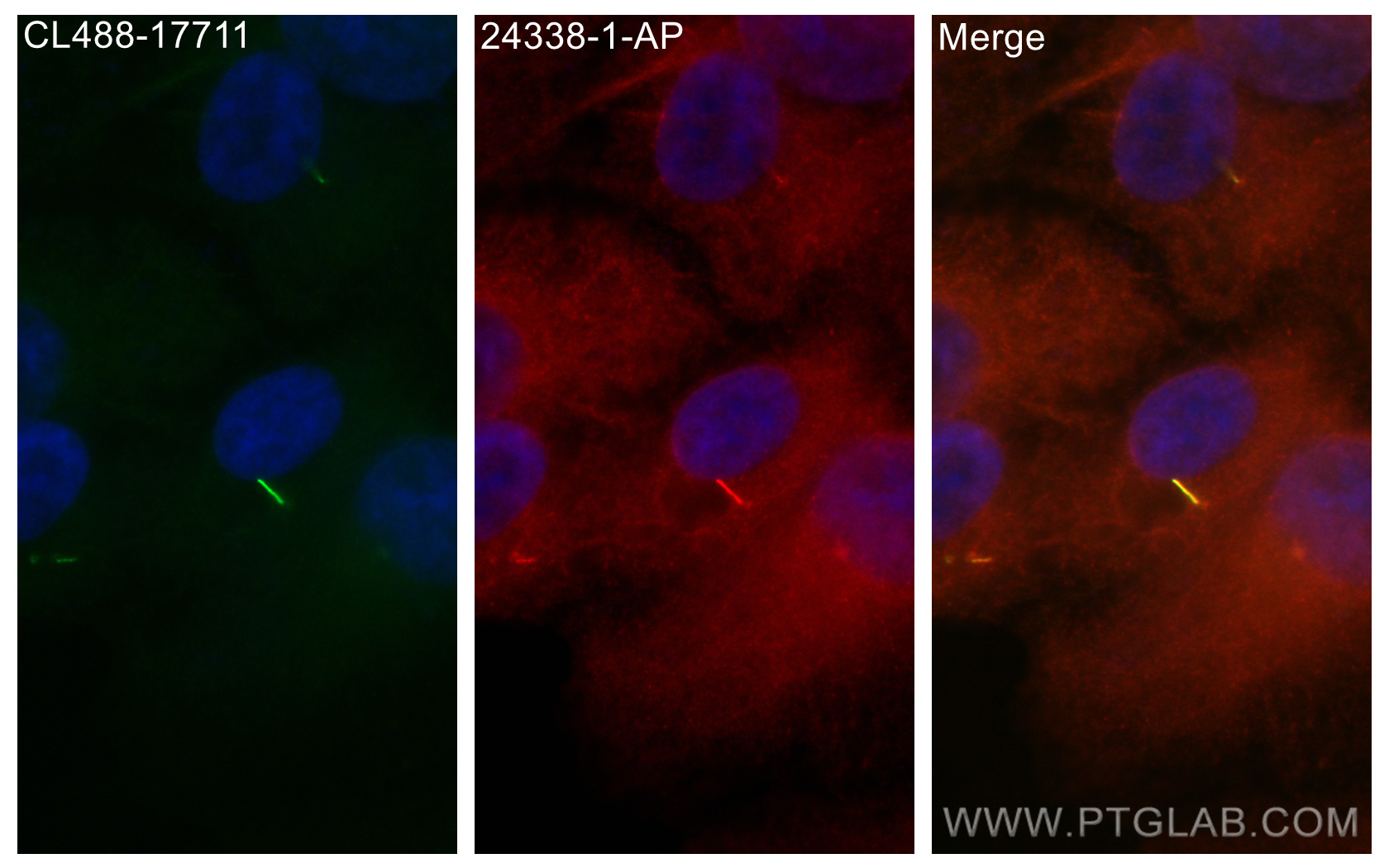 IF Staining of hTERT-RPE1 using 24338-1-AP