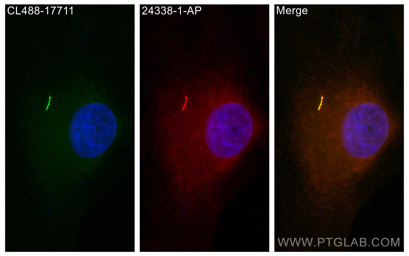 IF Staining of MDCK using 24338-1-AP