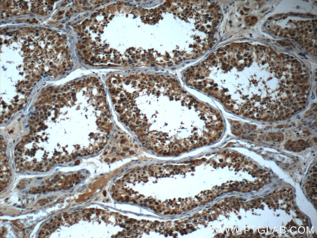 IHC staining of human testis using 24338-1-AP