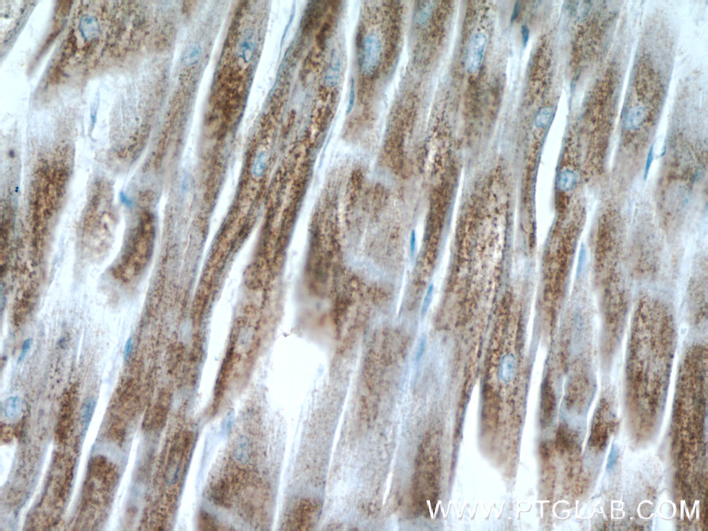 IHC staining of human heart using 14704-1-AP (same clone as 14704-1-PBS)