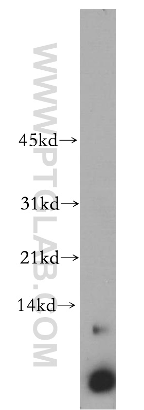WB analysis of Jurkat using 14704-1-AP (same clone as 14704-1-PBS)