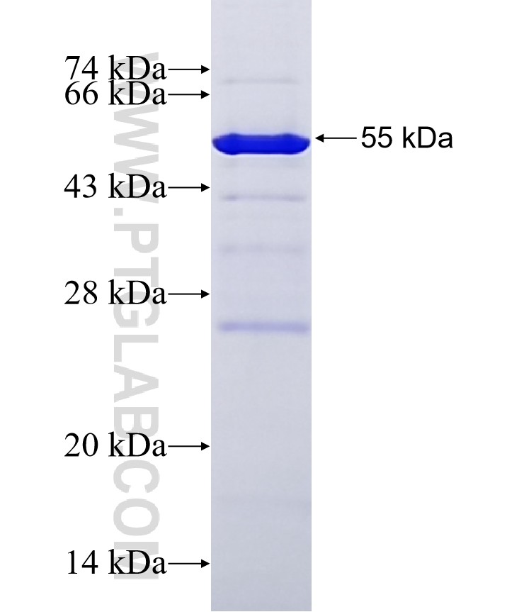 C14orf39 fusion protein Ag33548 SDS-PAGE C14orf39 fusion protein Ag33548 SDS-PAGE