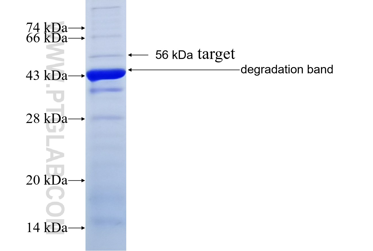 C14orf39 fusion protein Ag18670 SDS-PAGE C14orf39 fusion protein Ag18670 SDS-PAGE