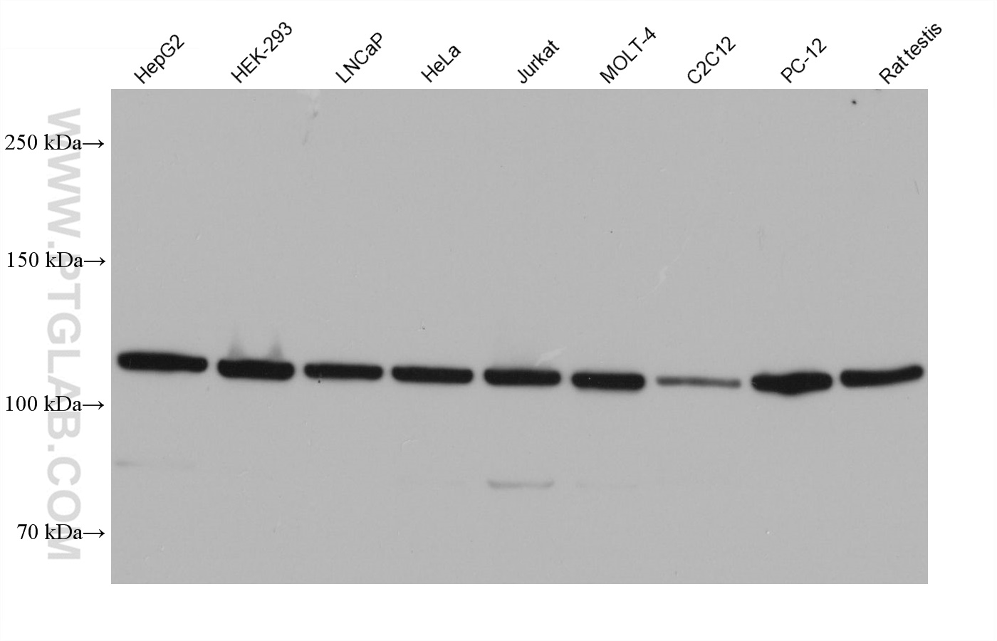 Nesprin 3